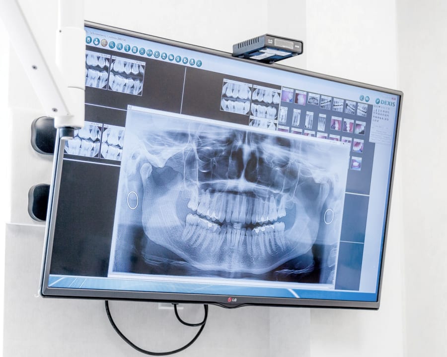 Dental Technology, Mississauga endodontist